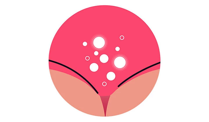 Abbildung der Einflüsse auf die Vaginalflora Abbildung der Einflüsse auf die Vaginalflora